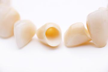 Image of dental crowns and bridges, Downey CA