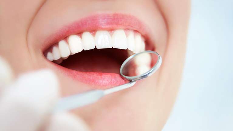 Small dental mirror tool next to an open mouth, downey ca