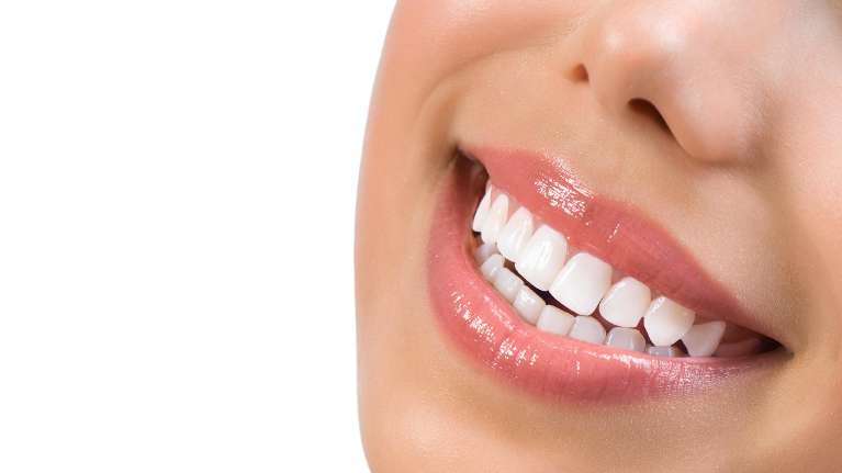 Woman smiling with white teeth after teeth whitening, downey ca