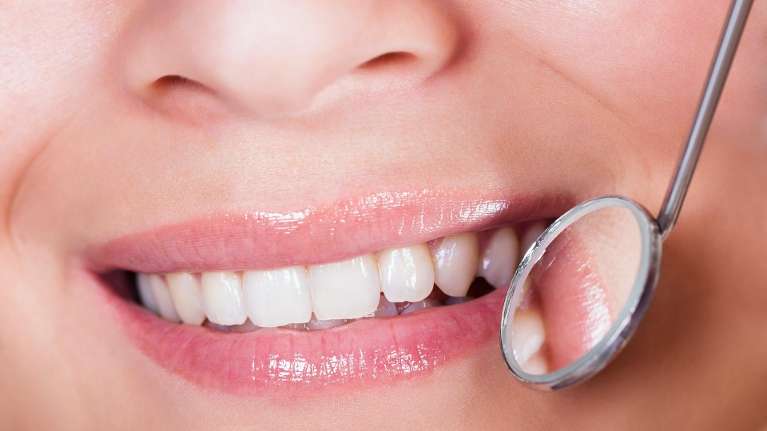 Regular Dental Checkups