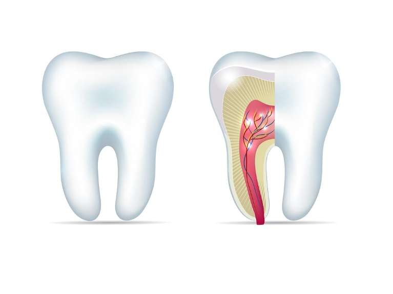 Diagram of a one normal tooth and the inside of a tooth about to get a root canal, downey ca